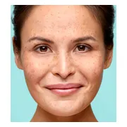 2x Biodermal Nachtcrème Gevoelige Huid 50 ml