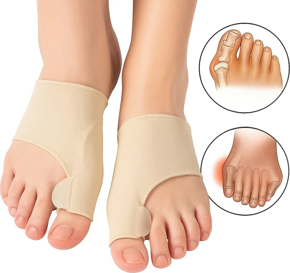 Hallux Valgus Teenbeschermers 2 Stuk I Teenspreiders I Teen Corrector I Knobbel I  Bunion I Eeltknobbel | Teen Rechtzetten I Beige